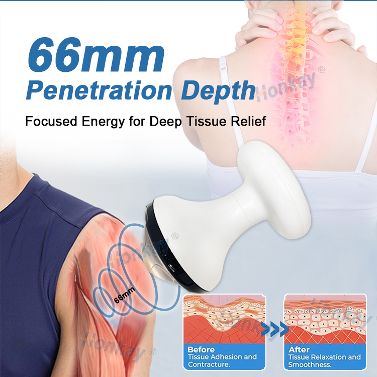 Focused shockwave handpiece shown reaching a depth of 66 mm into deep tissue, with an illustration of the tissue before and after treatment