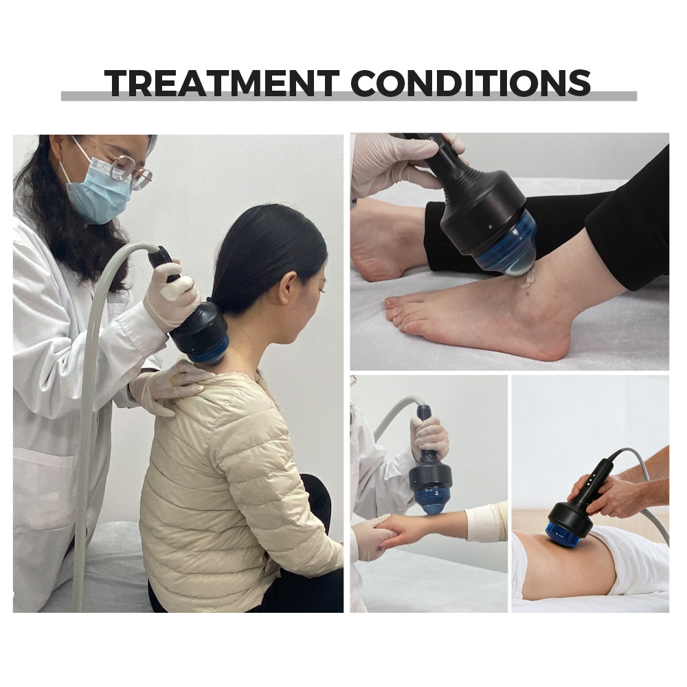 Focused shockwave treatment conditions shown as clinical photographs: neck therapy, ankle and heel therapy, hand and wrist therapy, and knee and back therapy