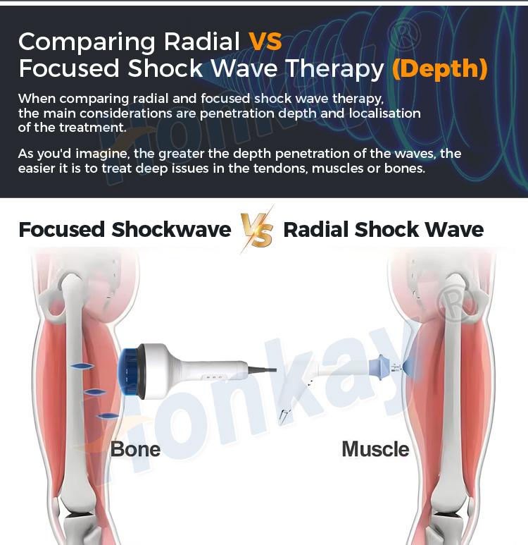 Diagram comparing focused shockwave therapy and radial shockwave depth: the focused applicator converges on bone while the radial applicator spreads through superficial muscle