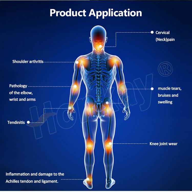Product application map for a pemf unit showing labelled treatment areas including cervical pain, shoulder arthritis, elbow wrist and arm pathology, tendinitis, knee joint wear, muscle tears and swelling, and Achilles tendon inflammation
