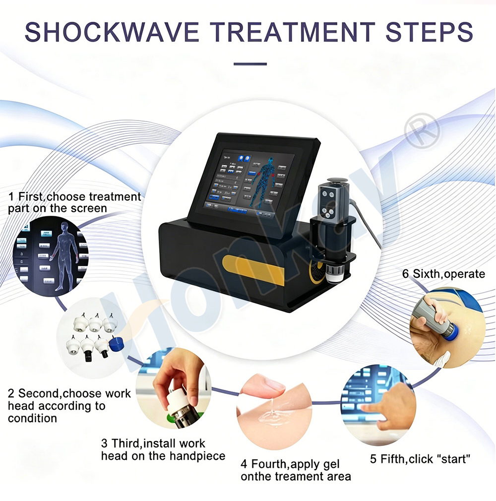 Shockwave treatment steps illustrated in six stages: choose the treatment part on the screen, choose the work head for the condition, install the head on the handpiece, apply gel to the area, click start, then operate