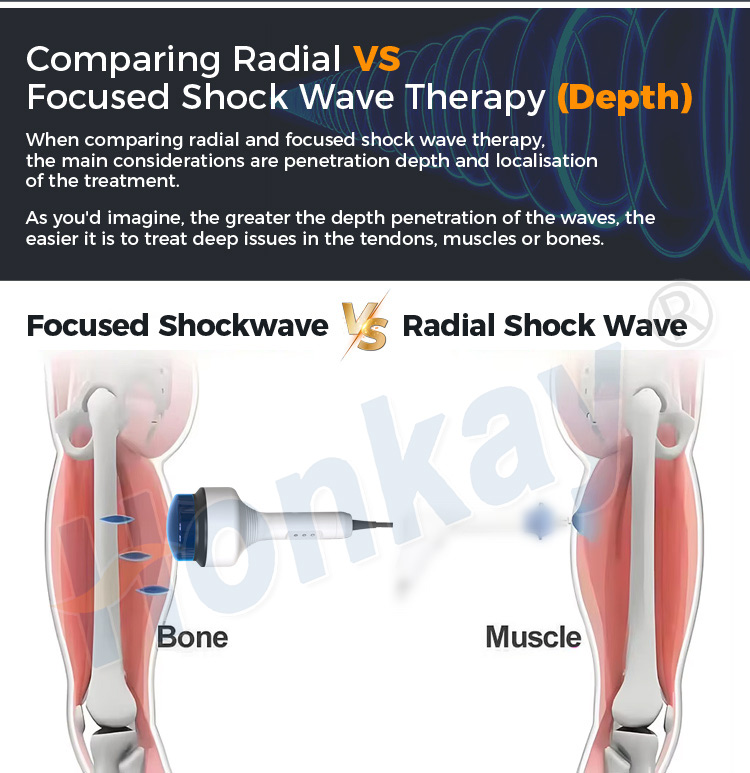 Diagram comparing radial and focused shockwave geometry, with the focused beam converging below the skin and the radial wave spreading from the applicator face