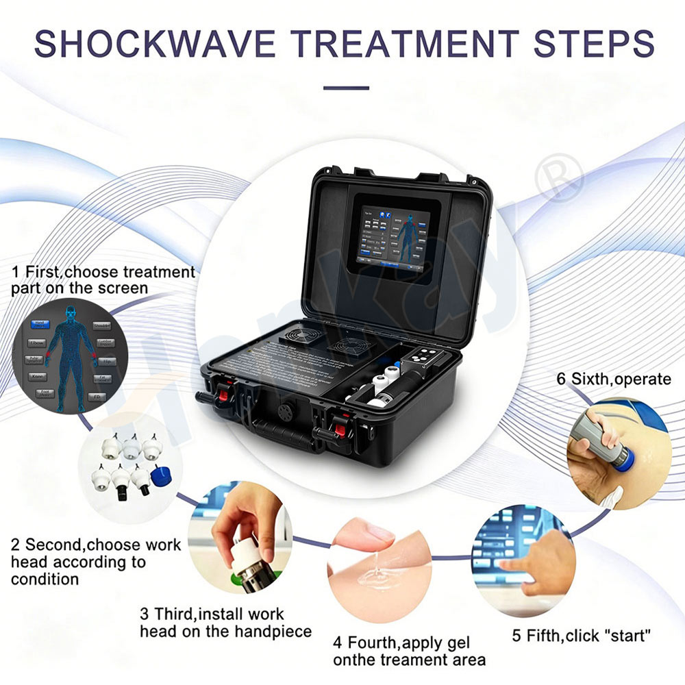 Six-step shockwave treatment workflow from selecting the body area on screen through fitting the working head, applying coupling gel and starting delivery